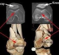 X-Ray, MRI, Medical imaging image
